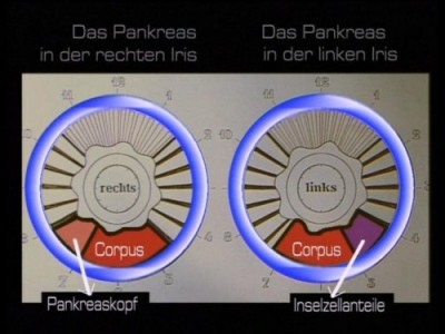 DVD: Irisdiagnose Weiterbildung (Bild 5)