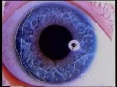 DVD: Irisdiagnose Einf�hrung (Bild 1)