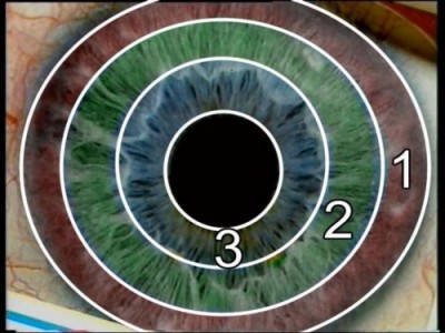 DVD: Irisdiagnose Einf�hrung (Bild 4)