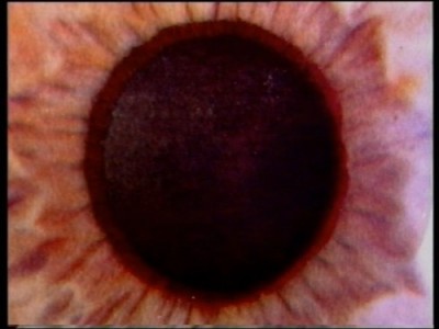 DVD: Irisdiagnose Einf�hrung (Bild 5)