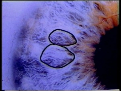 DVD: Irisdiagnose Einf�hrung (Bild 6)